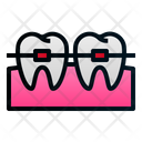 پیش‌نمایش فایل braces-1834301 از پک دندانپزشکی