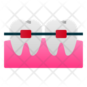پیش‌نمایش فایل braces-1834327 از پک دندانپزشکی