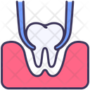 پیش‌نمایش فایل extraction-tooth-2495365 از پک دندانپزشکی