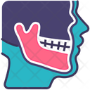 پیش‌نمایش فایل jaw-2495377 از پک دندانپزشکی
