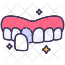 پیش‌نمایش فایل veneers-2495369 از پک دندانپزشکی
