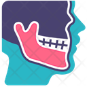 پیش‌نمایش فایل jaw-2495413 از پک دندانپزشکی