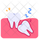 پیش‌نمایش فایل wisdom-teeth-2495398 از پک دندانپزشکی