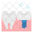 پیش‌نمایش فایل implant-2343797 از پک دندانپزشکی