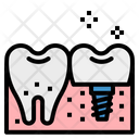 پیش‌نمایش فایل implant-2343756 از پک دندانپزشکی