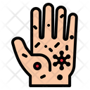 پیش‌نمایش فایل infected-hand-2802321 از پک پیشگیری کووید-۱۹