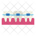 پیش‌نمایش فایل braces-7012005 از پک دندانپزشکی