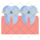پیش‌نمایش فایل braces-9511436 از پک دندان، دندانپزشکی