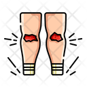 پیش‌نمایش فایل knee-wound-7602553 از پک آسیب‌ها و شکستگی‌ها