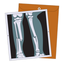 پیش‌نمایش فایل broken-leg-x-ray-5384104 از پک افراد توانایی پارا