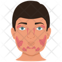 پیش‌نمایش فایل mikulicz-syndrome-3581865 از پک غدد بزاقی