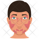 پیش‌نمایش فایل mikulicz-syndrome-3581873 از پک غدد بزاقی