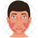 پیش‌نمایش فایل mikulicz-syndrome-3581881 از پک غدد بزاقی