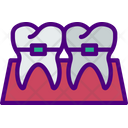 پیش‌نمایش فایل dental-braces-5235904 از پک دندانپزشکی