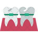 پیش‌نمایش فایل dental-braces-5235749 از پک دندانپزشکی