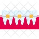 پیش‌نمایش فایل braces-7722076 از پک دندانپزشکی