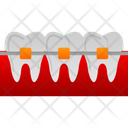 پیش‌نمایش فایل braces-7722231 از پک دندانپزشکی
