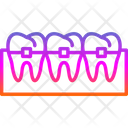 پیش‌نمایش فایل braces-7722668 از پک دندانپزشکی