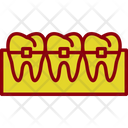 پیش‌نمایش فایل braces-7722993 از پک دندانپزشکی