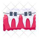 پیش‌نمایش فایل braces-7808013 از پک دندانپزشکی