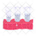 پیش‌نمایش فایل endosseous-implant-7808018 از پک دندانپزشکی