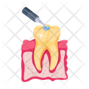 پیش‌نمایش فایل root-canal-7807990 از پک دندانپزشکی