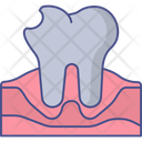 پیش‌نمایش فایل cavity-10971679 از پک دندانپزشکی