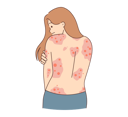 پیش‌نمایش فایل girl-with-skin-rashes-8633594 از پک متفرقه