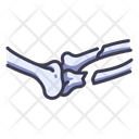 پیش‌نمایش فایل broken-bone-2054598 از پک بدن انسان