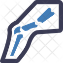 پیش‌نمایش فایل broken-leg-5475444 از پک پزشکی - بخش 1