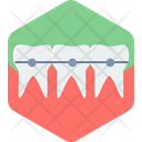 پیش‌نمایش فایل braces-9383848 از پک پزشکی