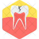 پیش‌نمایش فایل tooth-cavity-9383842 از پک پزشکی