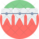 پیش‌نمایش فایل braces-9574171 از پک پزشکی