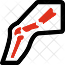 پیش‌نمایش فایل broken-leg-10945799 از پک پزشکی