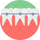 پیش‌نمایش فایل braces-11172704 از پک پزشکی
