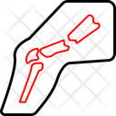 پیش‌نمایش فایل broken-leg-12537291 از پک پزشکی