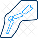 پیش‌نمایش فایل broken-leg-12532418 از پک پزشکی