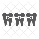پیش‌نمایش فایل teeth-braces-1583106 از پک دندانپزشکی