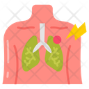 پیش‌نمایش فایل pneumonia-9465892 از پک ویروس کرونا