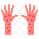 پیش‌نمایش فایل rashes-9465870 از پک ویروس کرونا
