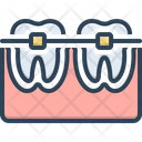 پیش‌نمایش فایل tooth-with-braces-2279474 از پک پزشکی و سلامت