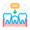پیش‌نمایش فایل crown-teeth-2017906 از پک دندانپزشکی