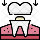 پیش‌نمایش فایل dental-crown-4788875 از پک دندان‌پزشکی