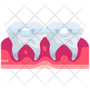 پیش‌نمایش فایل braces-5008648 از پک دندان‌پزشکی