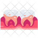 پیش‌نمایش فایل gingivitis-5008669 از پک دندان‌پزشکی