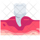 پیش‌نمایش فایل premolar-5008682 از پک دندان‌پزشکی