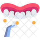 پیش‌نمایش فایل veneers-5008694 از پک دندان‌پزشکی