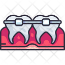پیش‌نمایش فایل braces-5008710 از پک دندان‌پزشکی