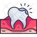 پیش‌نمایش فایل cavity-5008713 از پک دندان‌پزشکی