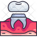 پیش‌نمایش فایل dental-crown-5008718 از پک دندان‌پزشکی